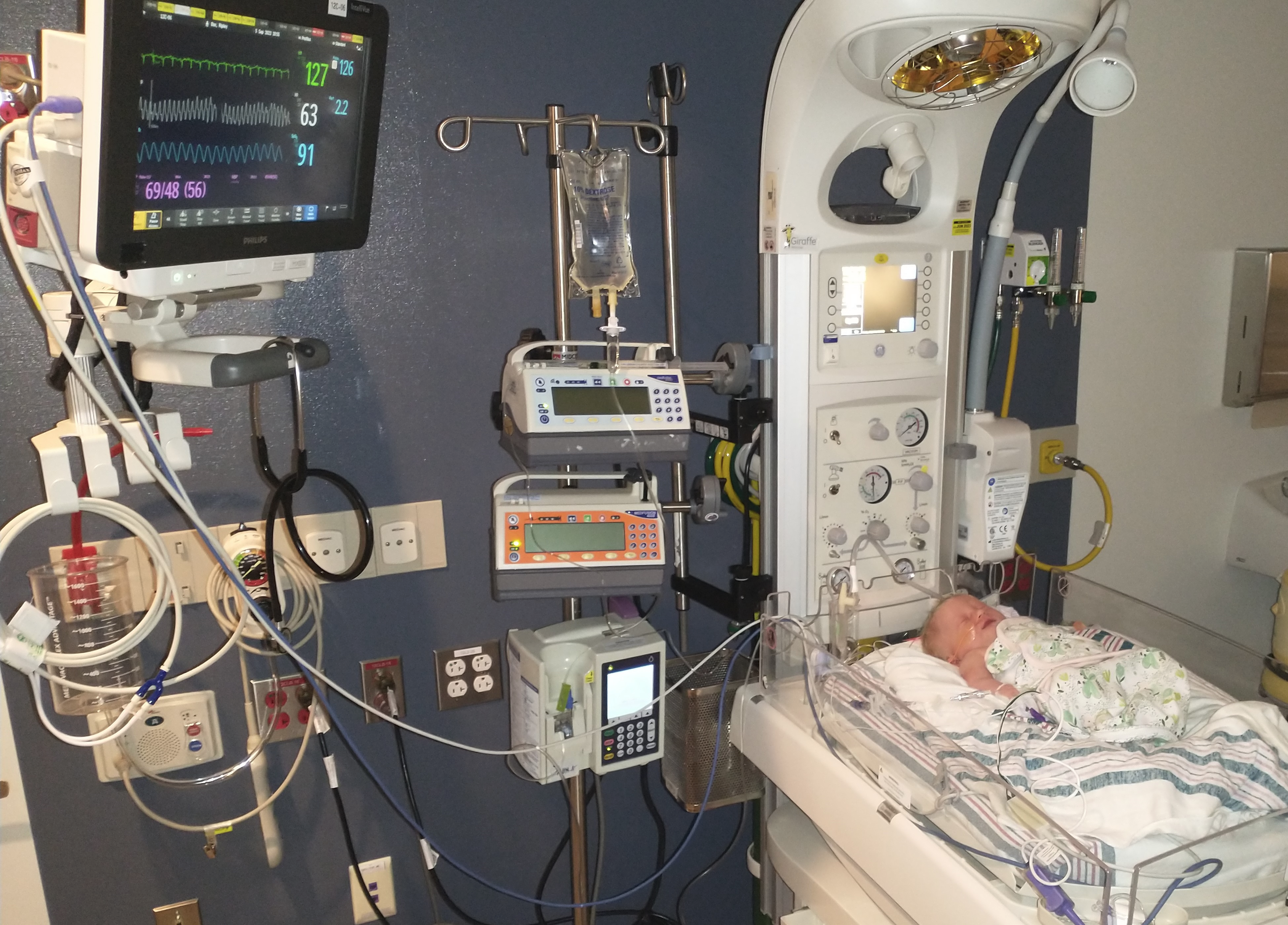 Photo of a baby in a NICU bed with oxygen, feeding tube and monitoring equipment attached.